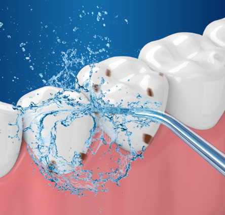Working principle of the dental irrigator